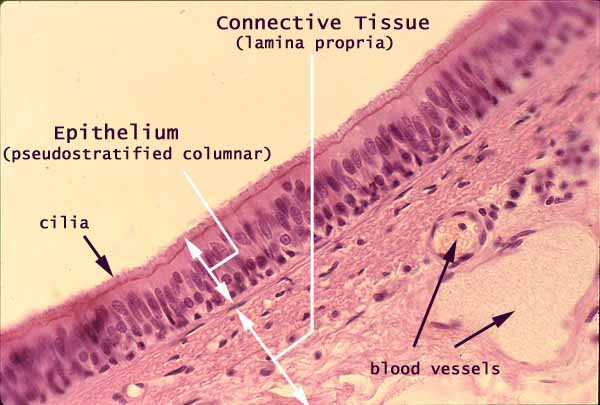 pseudostratified columnar labeled