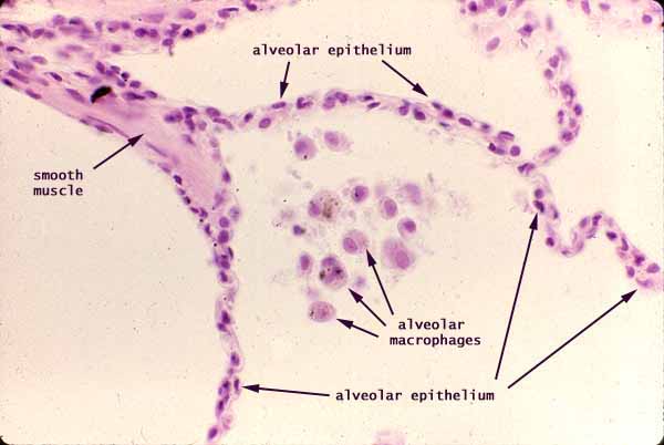 alveolar macrophage histology