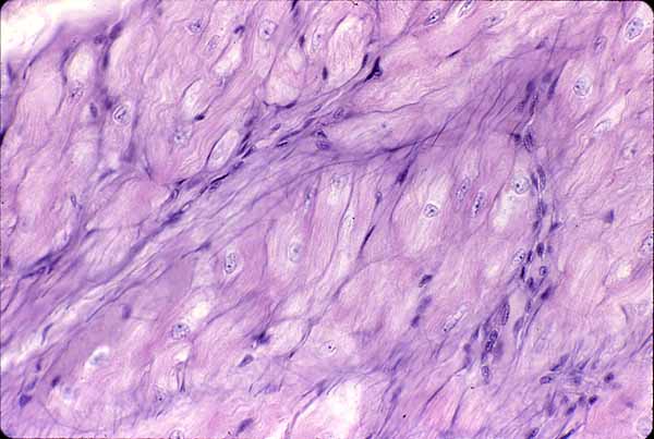 purkinje fibers histology