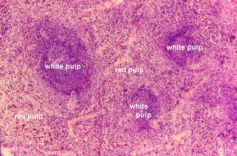 Spleen Histology White Pulp