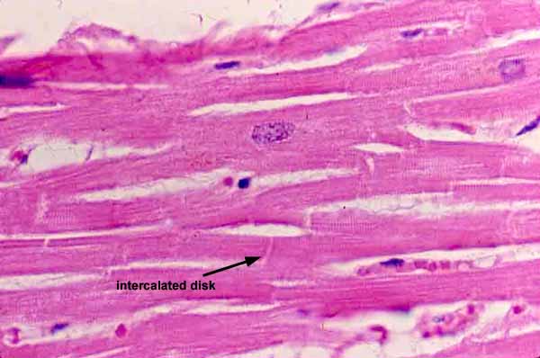 cardiac muscle striations