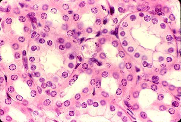 simple squamous epithelium slide labeled