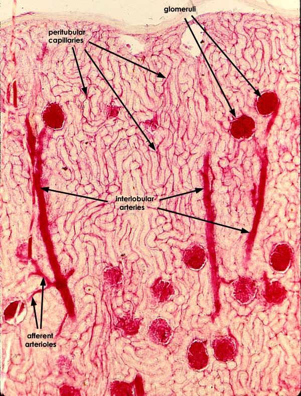 kidney slide labeled