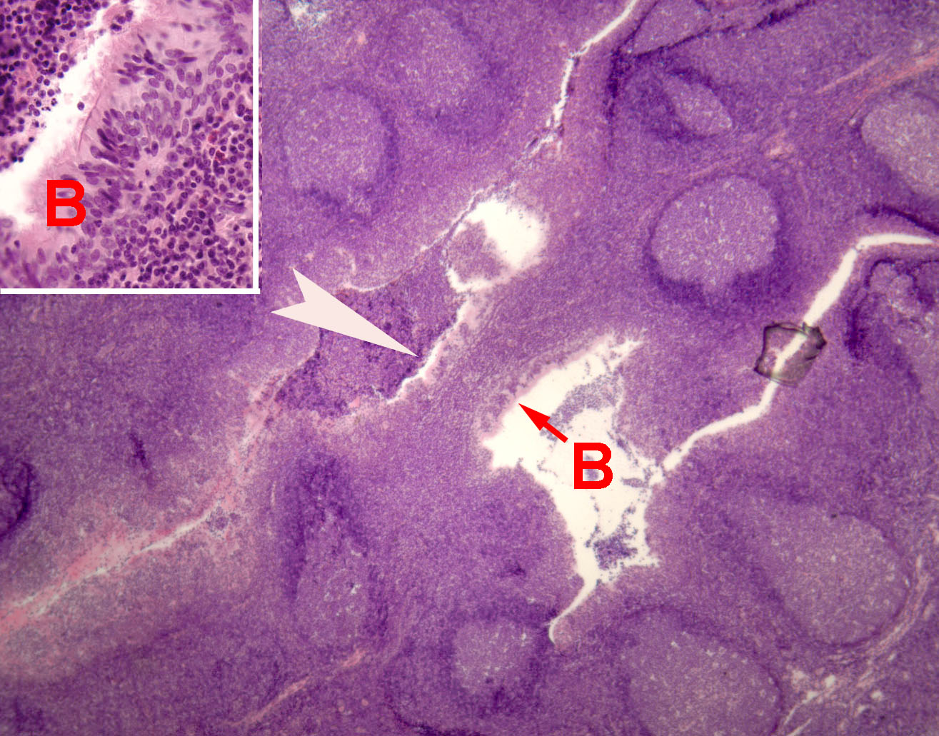 arteries and veins histology