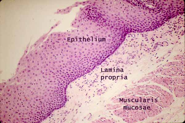 stratified squamous epithelium non keratinized esophagus