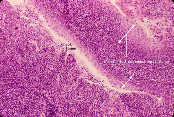 thymus histology labeled trabeculae