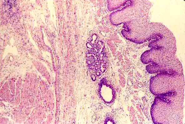 micrograph of epithelium and connective tissue