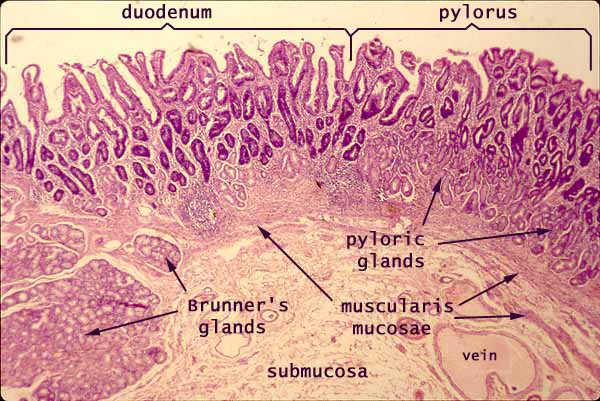 Brunner's glands in on sale duodenum