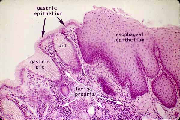 histology of esophagus and stomach