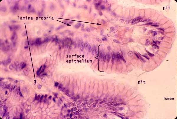 goblet cells in stomach