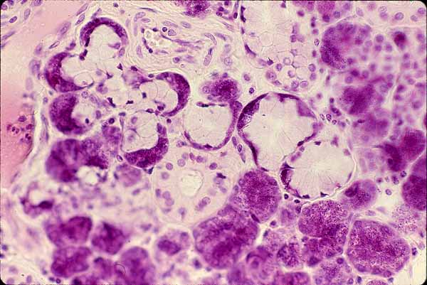 parotid histology