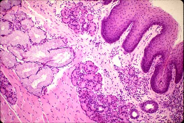 hard palate histology