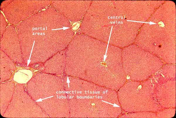 portal triad histology