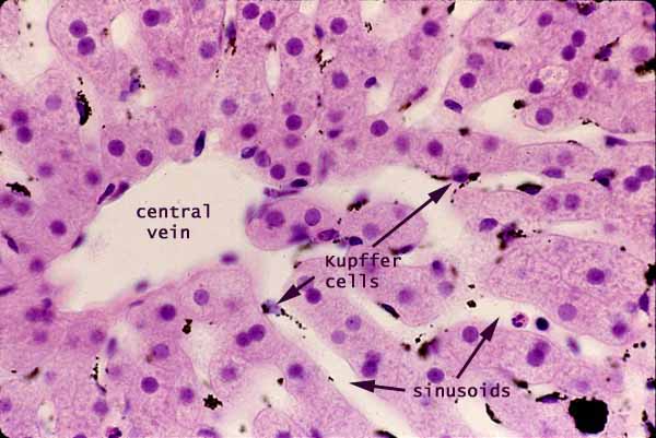 liver histology sinusoids