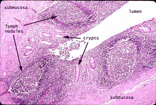 appendix histology