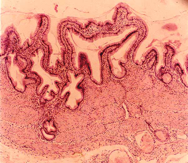 gallbladder histology labeled