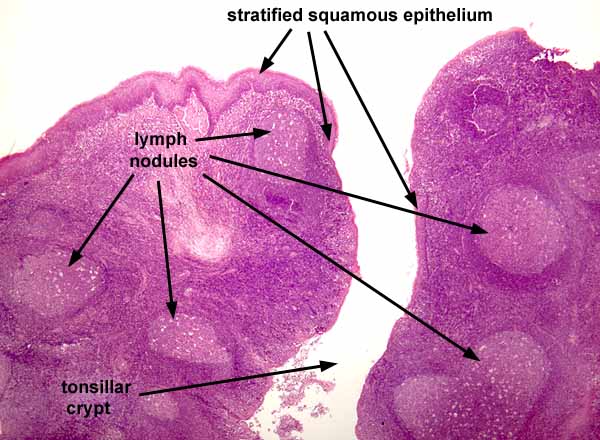 tonsil histology labeled