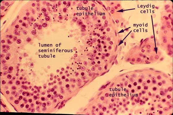 testis slide interstitial cells