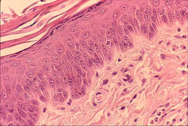 skin layers histology