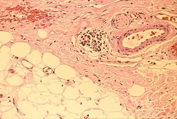 adipose connective tissue slide