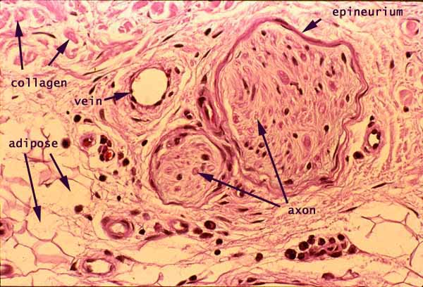 schwann cell histology