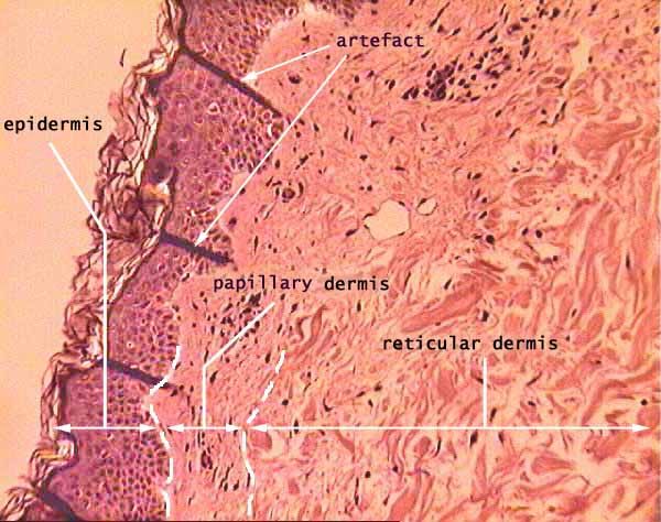 layers of dermis papillary reticular