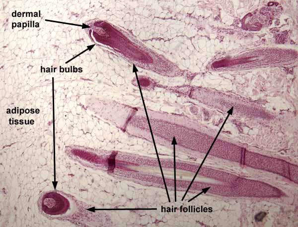 hair under microscope labeled