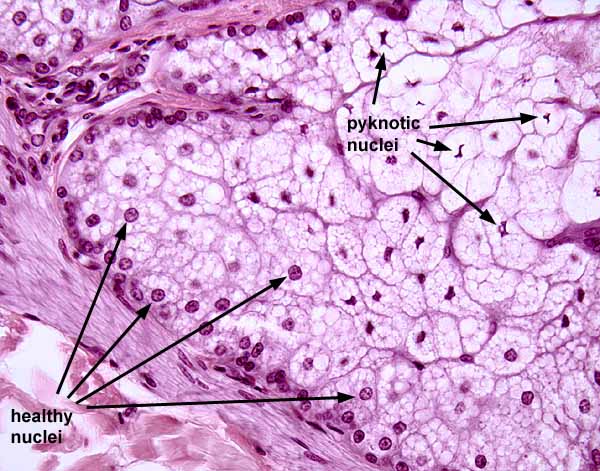 sebaceous glands histology