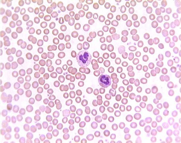 basophils neutrophils lymphocytes monocytes eosinophils