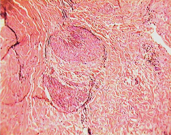 Siu Som Histology Intro