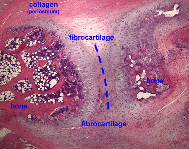 fibrocartilage connective tissue labeled