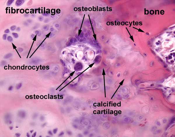 endochondral ossification histology