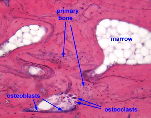 woven bone histology
