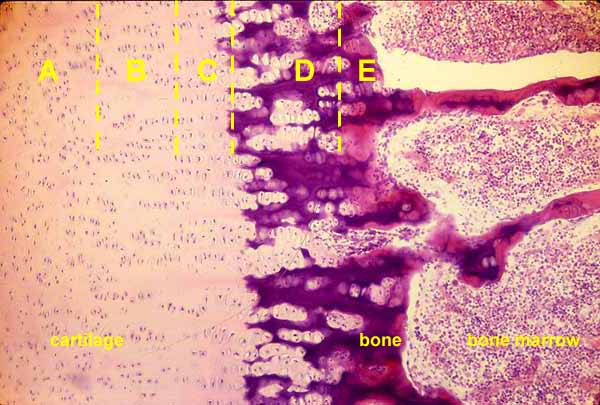 endochondral ossification histology